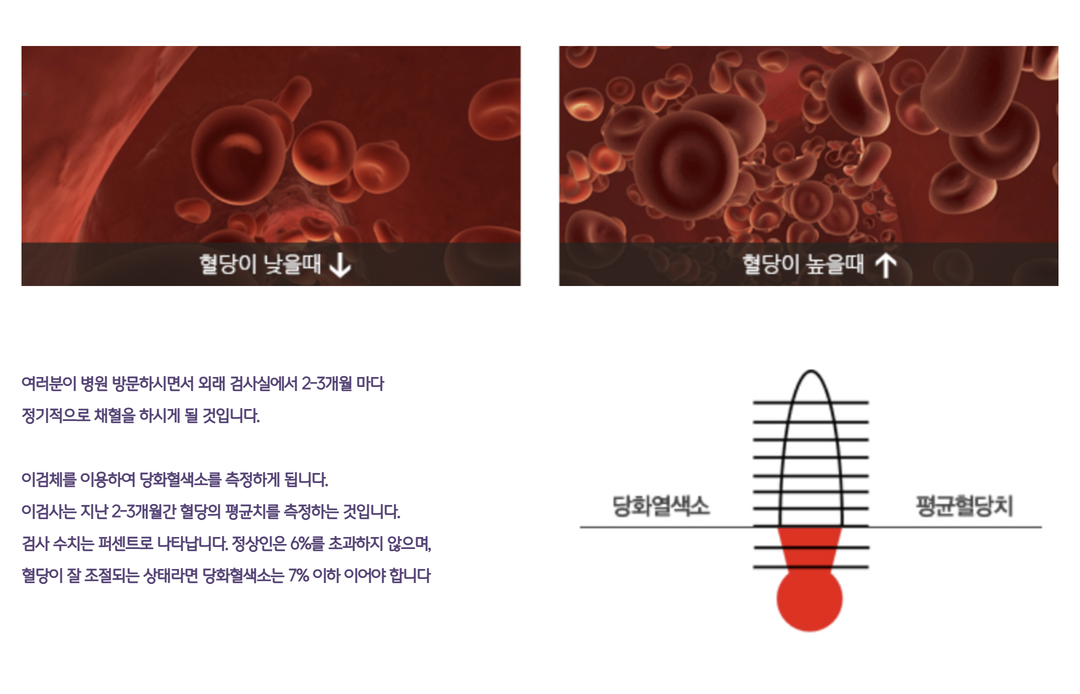 당뇨병이란_제일엔도.png